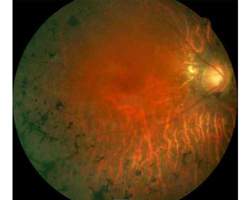 二代代生宝宝公司服务冻囊胚能转三代筛查吗?