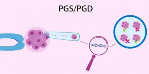 株洲三代试管机构可以签约吗,运行了哪些技术