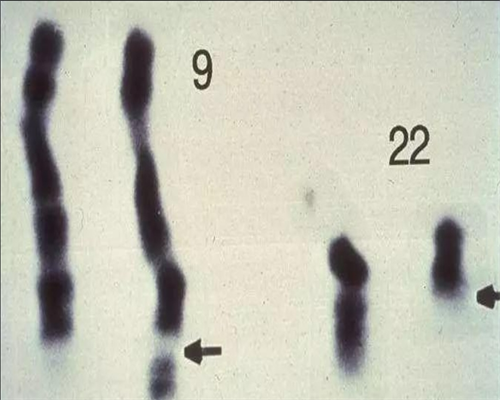 三个卵泡做做代生要多少费用成功案例,三个卵泡做做代生要多少费用成功案例